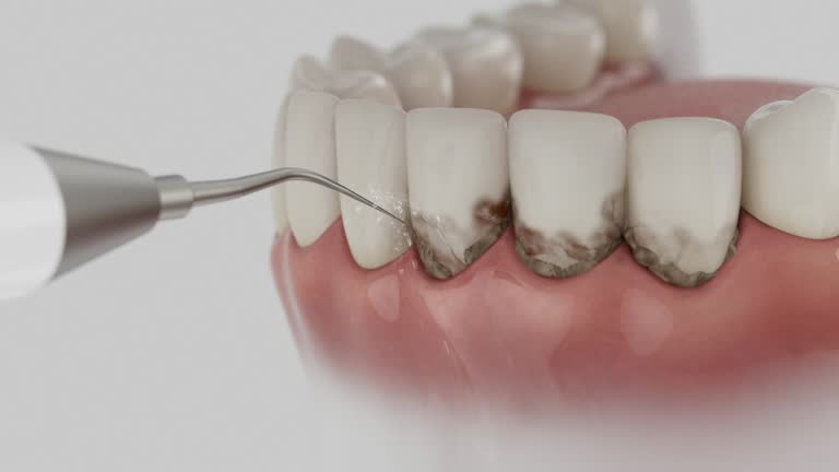 Reliable Dental Implants contractor in Slocomb, AL by Smile Center Dentistry
